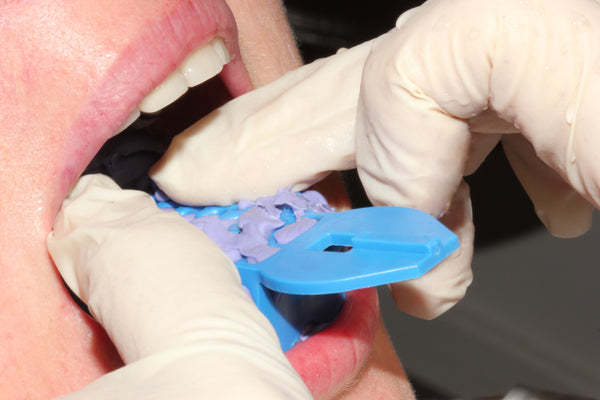 Why you should use impression material specifically formulated for sequential aligner therapy (Invisalign)
